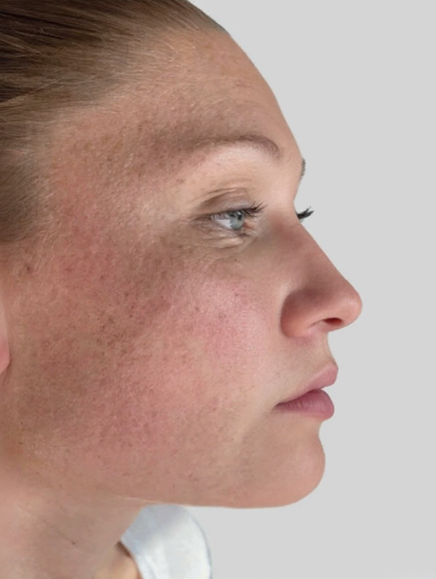 Skin on day 1