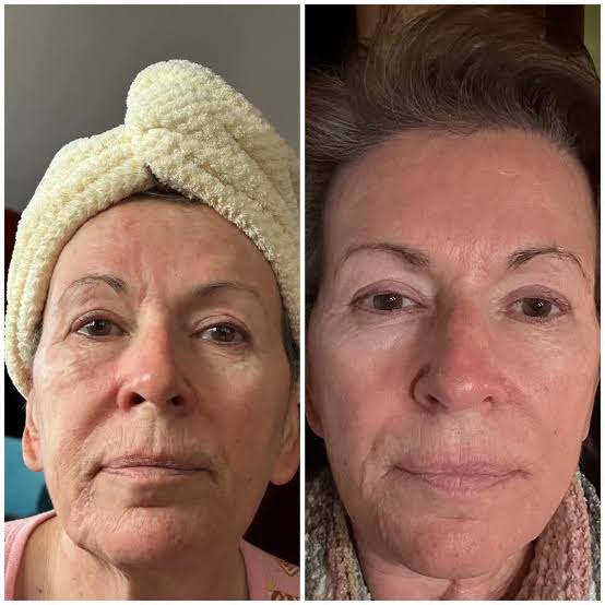 Customer photo