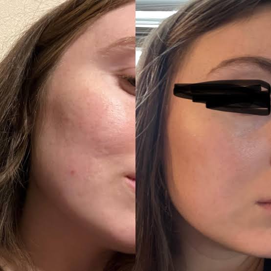 Customer photo